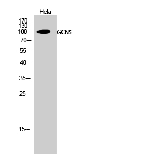 Rabbit Polyclonal Antibody to GCN5