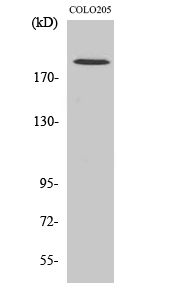 Rabbit Polyclonal Antibody to GCP6