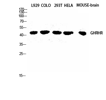 Rabbit Polyclonal Antibody to GHRH-R