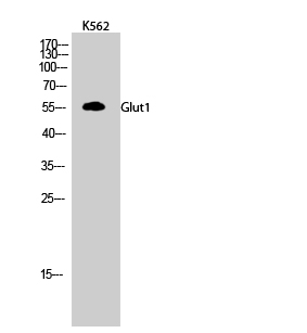 Rabbit Polyclonal Antibody to Glut1