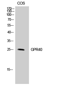 Rabbit Polyclonal Antibody to GPR40