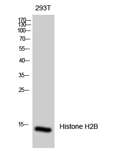 Rabbit Polyclonal Antibody to Histone H2B
