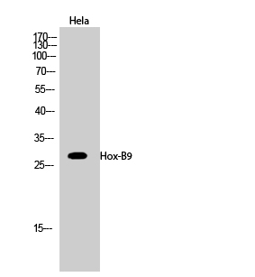 Rabbit Polyclonal Antibody to Hox-B9
