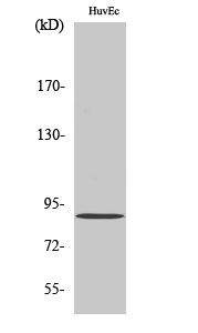 Rabbit Polyclonal Antibody to iPLA2γ