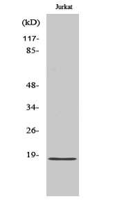 Rabbit Polyclonal Antibody to KEPI
