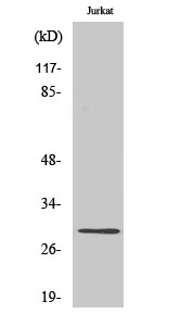 Rabbit Polyclonal Antibody to LDLRAD2