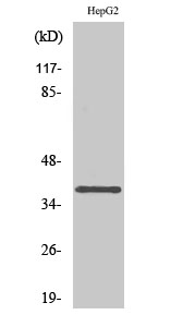 Rabbit Polyclonal Antibody to L-type Ca++ CP γ7