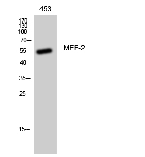 Rabbit Polyclonal Antibody to MEF-2