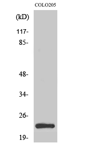 Rabbit Polyclonal Antibody to MRP-L21