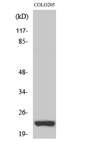 Rabbit Polyclonal Antibody to NEEP21
