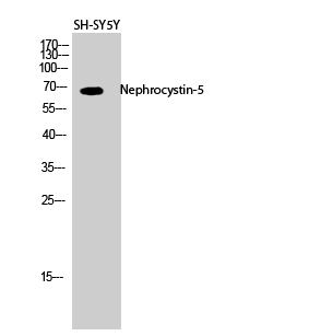 Rabbit Polyclonal Antibody to Nephrocystin-5