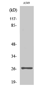 Rabbit Polyclonal Antibody to NET-5