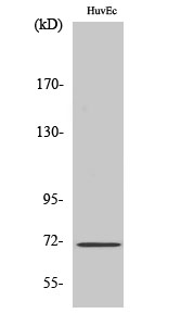 Rabbit Polyclonal Antibody to NF2