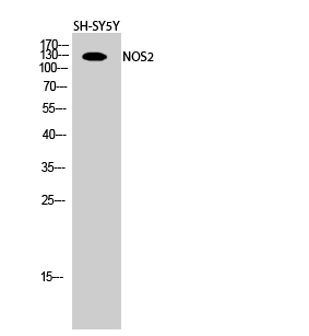 Rabbit Polyclonal Antibody to NOS2