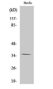 Rabbit Polyclonal Antibody to Olfactory receptor 11G2