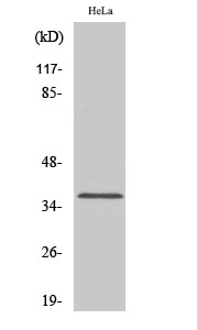 Rabbit Polyclonal Antibody to Olfactory receptor 1D4/1D5
