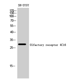 Rabbit Polyclonal Antibody to Olfactory receptor 4C16