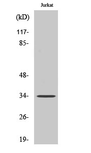 Rabbit Polyclonal Antibody to Olfactory receptor 4D1