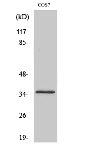 Rabbit Polyclonal Antibody to Olfactory receptor 4K14