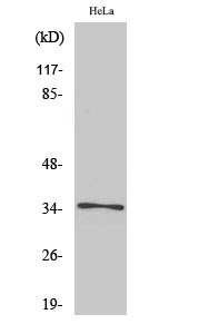 Rabbit Polyclonal Antibody to Olfactory receptor 52E6