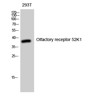 Rabbit Polyclonal Antibody to Olfactory receptor 52K1