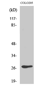 Rabbit Polyclonal Antibody to Olfactory receptor 5D3