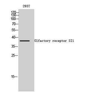 Rabbit Polyclonal Antibody to Olfactory receptor 5I1