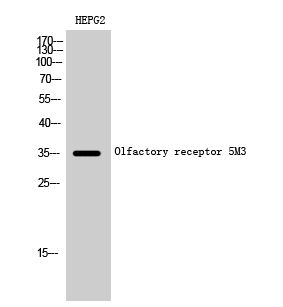 Rabbit Polyclonal Antibody to Olfactory receptor 5M3