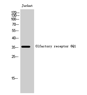 Rabbit Polyclonal Antibody to Olfactory receptor 6Q1