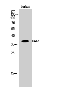 Rabbit Polyclonal Antibody to PAI-1