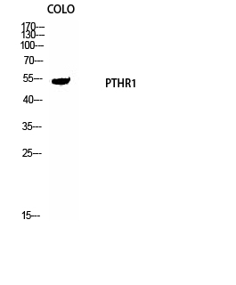 Rabbit Polyclonal Antibody to PTH/PTHrP-R