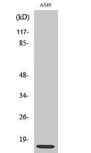 Rabbit Polyclonal Antibody to Ribosomal Protein L30