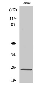 Rabbit Polyclonal Antibody to Rit1