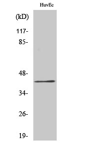 Rabbit Polyclonal Antibody to RRS1
