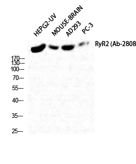 Rabbit Polyclonal Antibody to RyR-2
