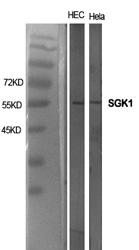 Rabbit Polyclonal Antibody to SGK1
