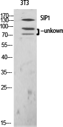 Rabbit Polyclonal Antibody to SIP1