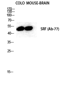 Rabbit Polyclonal Antibody to SRF