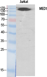 Rabbit Polyclonal Antibody to TRAP220
