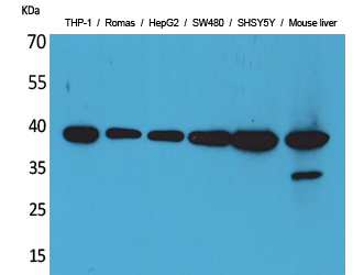 Rabbit Polyclonal Antibody to IL-10