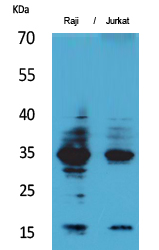 Rabbit Polyclonal Antibody to IL-4