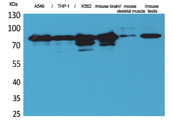 Rabbit Polyclonal Antibody to PKC γ