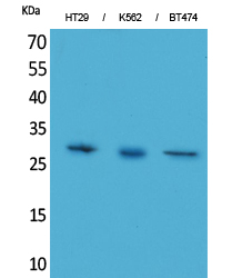 Rabbit Polyclonal Antibody to BRMS-1