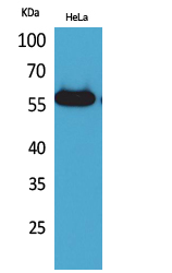Rabbit Polyclonal Antibody to Amylase