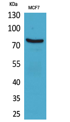 Rabbit Polyclonal Antibody to CD66e