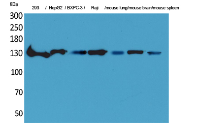 Rabbit Polyclonal Antibody to IL-16