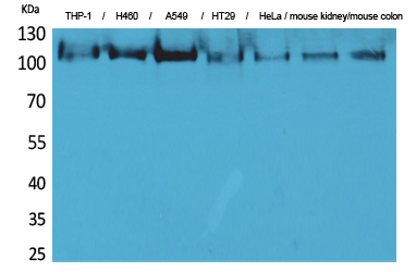Rabbit Polyclonal Antibody to cPLA2