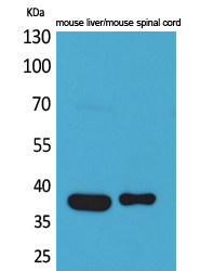 Rabbit Polyclonal Antibody to Aldolase C