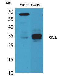 Rabbit Polyclonal Antibody to SP-A