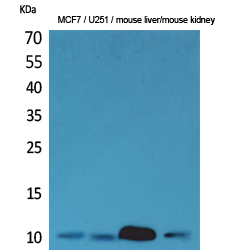 Rabbit Polyclonal Antibody to ACBP